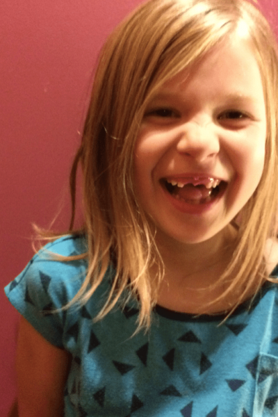 Girl smiling with front teeth missing